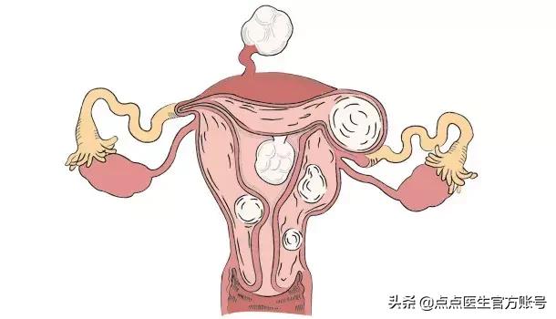 50-60岁体检套餐还是自选划算,女性体检套餐检查项目怎么选