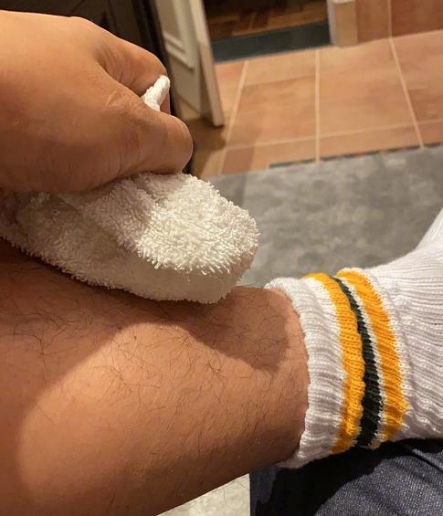 张亮摔伤怎么样,张亮晒受伤照被网友骂