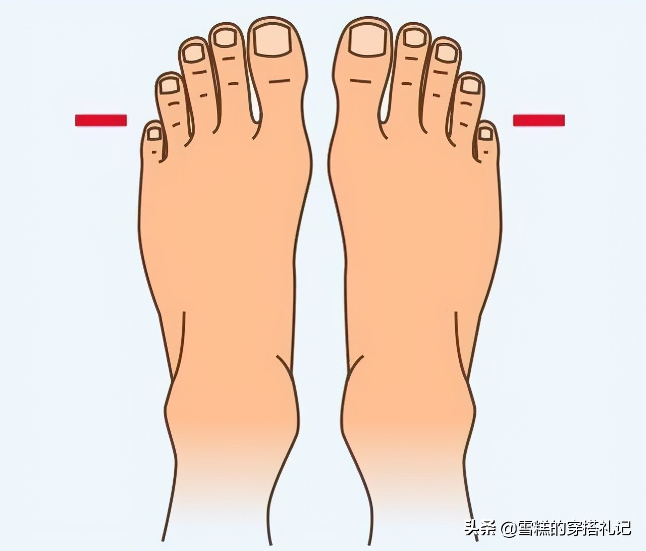 夏天配裙子的百搭鞋,圆头高腰鞋怎么搭配裤子好看