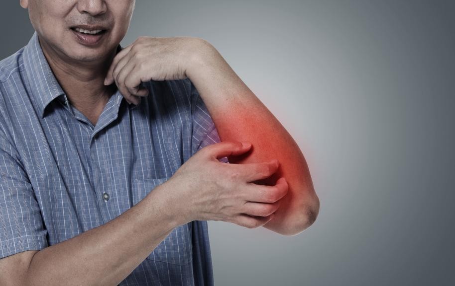 瘙痒症和皮肤瘙痒有什么区别,瘙痒症状怎么治疗