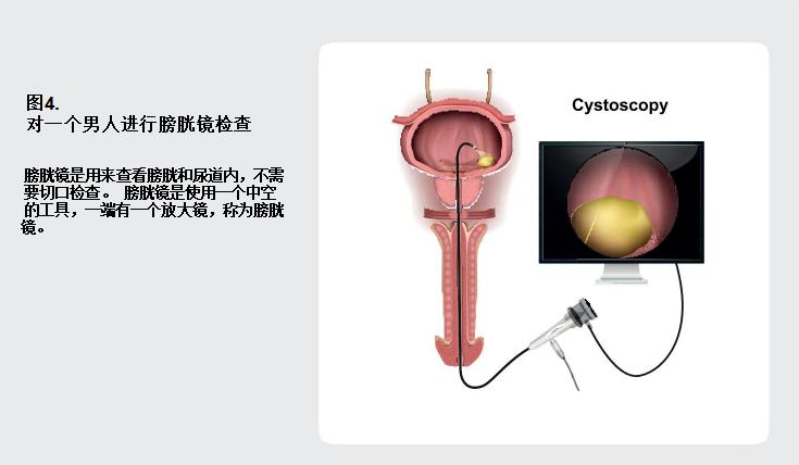 谈癌色变的治疗方法,谈癌色变是什么病