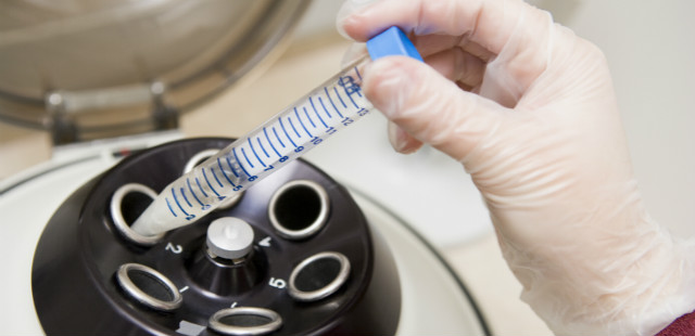 林志玲什么时候冻卵子,林志玲为什么要冻卵