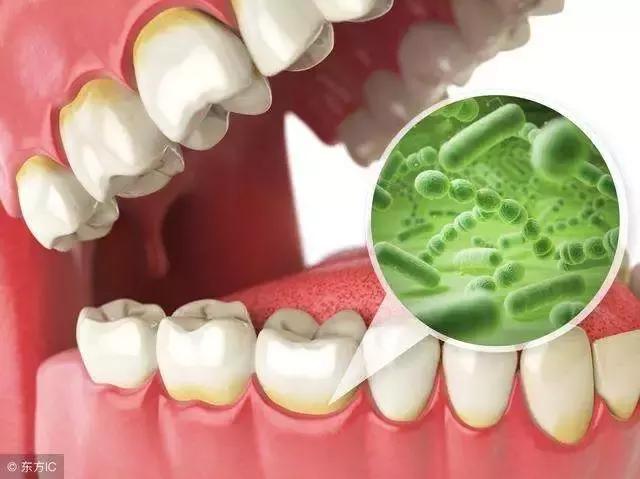 菌群在呼吸道和口腔炎症和感染中的作用