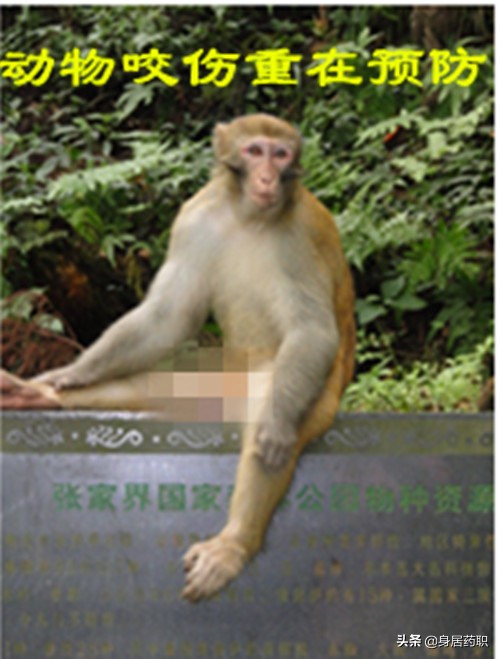 动物咬伤后的处理急救知识的海报,动物咬伤急救常识动画