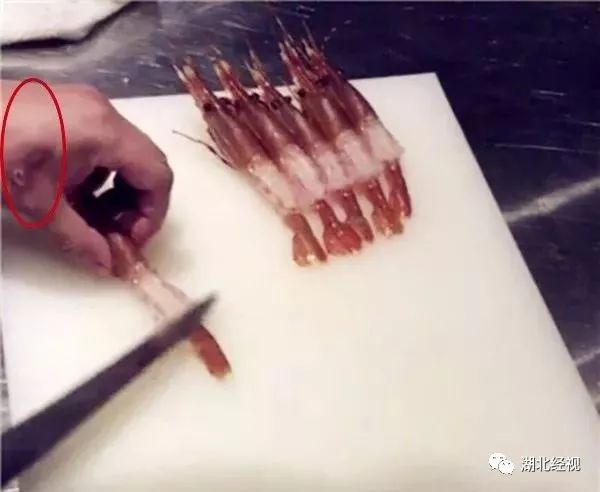 网红日料店被曝,日料店厨师手上有疮