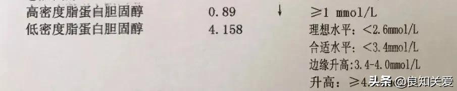 血脂化验单没有也不可大意,一张图看懂高血脂