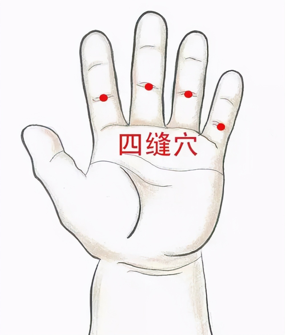 脾胃虚弱跟疳积的区别,积食和疳积的区别