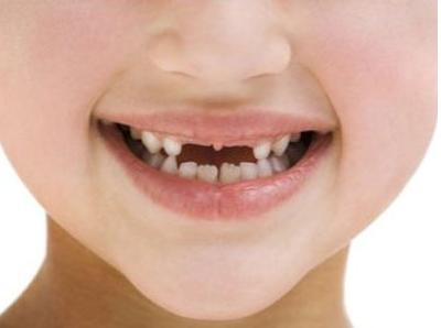 小孩乳牙不小心咽下去了怎么办,儿童乳牙摔松动了能自己恢复吗