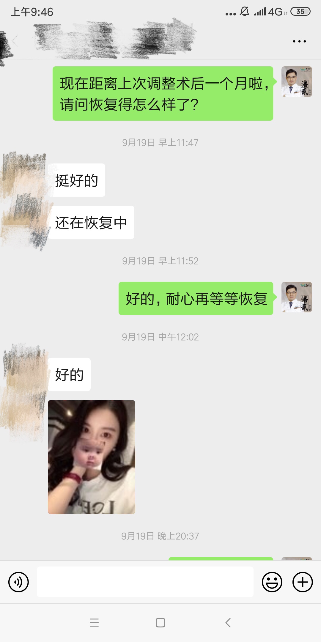 开内眼角会留疤的照片,开内眼角的疤痕变白色了怎么办