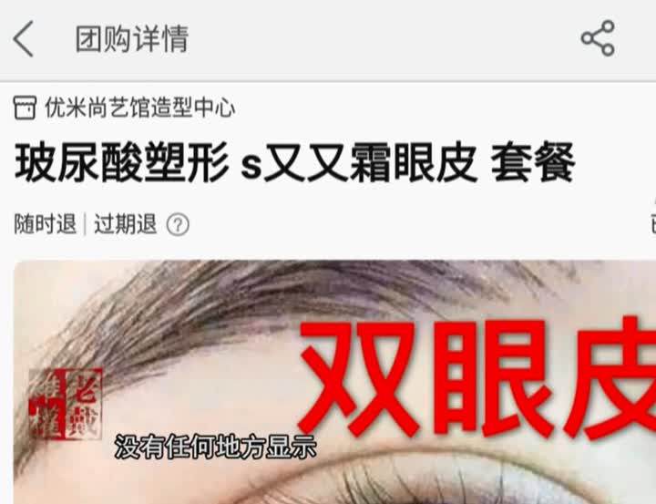 美团上的医美护肤品靠谱吗,美团上的玻尿酸要注射费吗