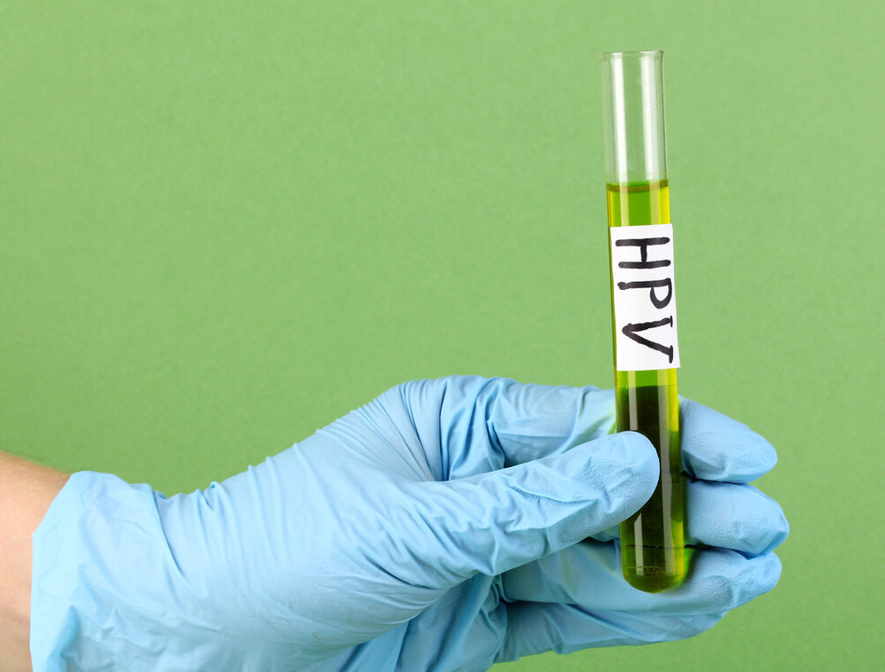 有hpv感染最怕做这几件事,身体发出4个信号证明你感染了hpv