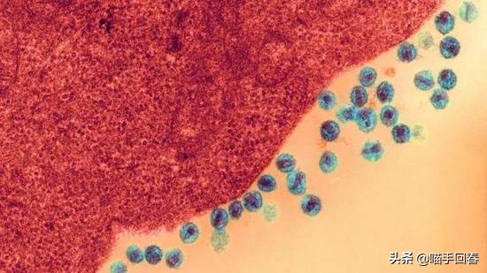 猫口炎就是猫艾滋吗,猫得了猫艾滋治不好怎么办