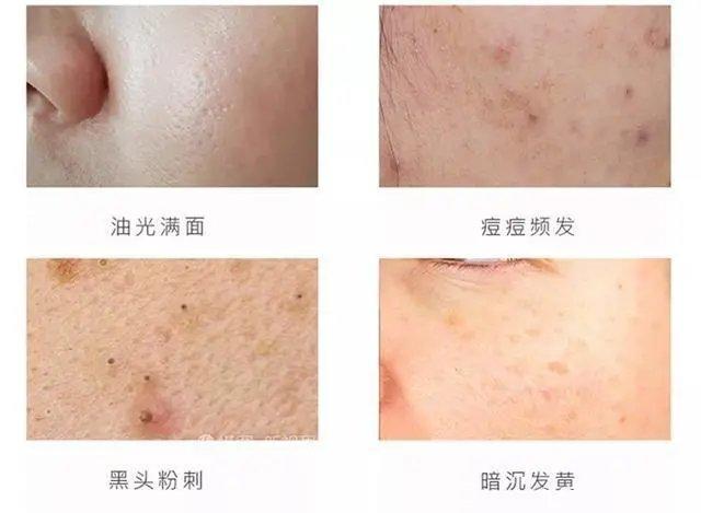 张嘉倪牛奶肌高清图,32岁张嘉倪全身照