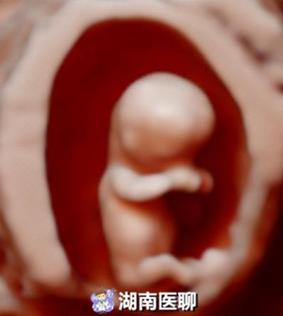 孕检四维五维,怀孕做了四维还要做二维三维吗