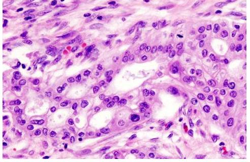 100亿活性乳酸菌,灭活乳酸杆菌