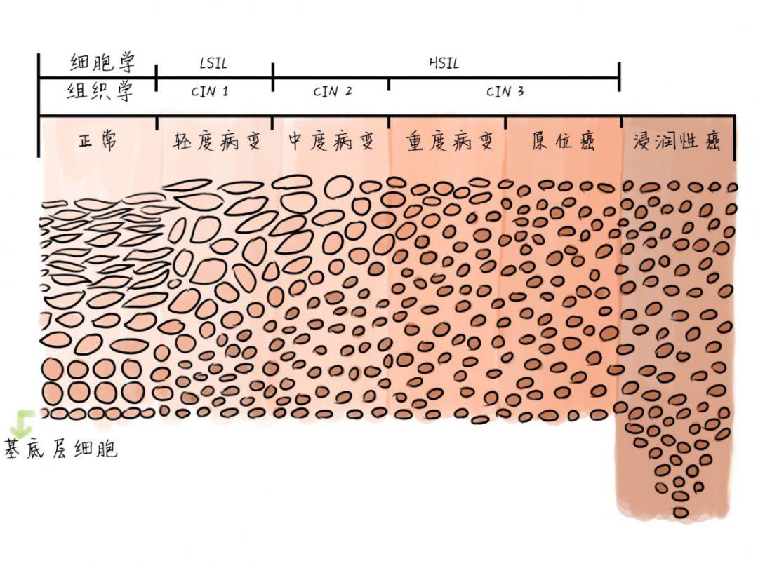 九价hpv疫苗最短间隔注射时间,hpv41感染症状