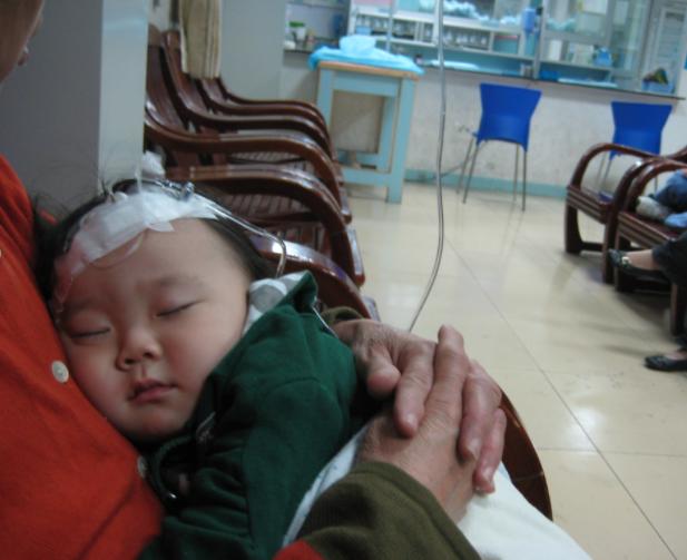 小孩锌缺了是啥症状,孩子锌元素摄入不足的表现