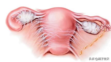 盆腔炎症治不好吗,盆腔炎症会不会导致不孕