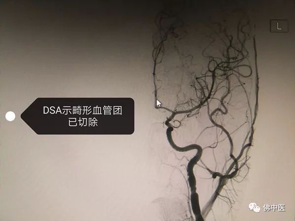 警惕熬夜,注意别仗着年轻就透支自己的身体