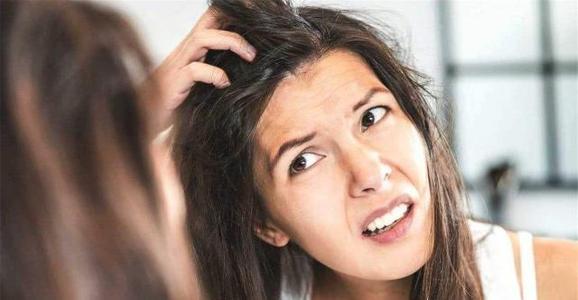 头皮上抠出白皮是头皮屑吗,头皮屑白泥是什么