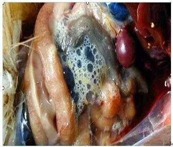 气囊炎如何形成的,气囊炎是什么原因引起