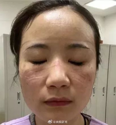 抗击疫情贵州支援恩施,抗击疫情贵州在行动