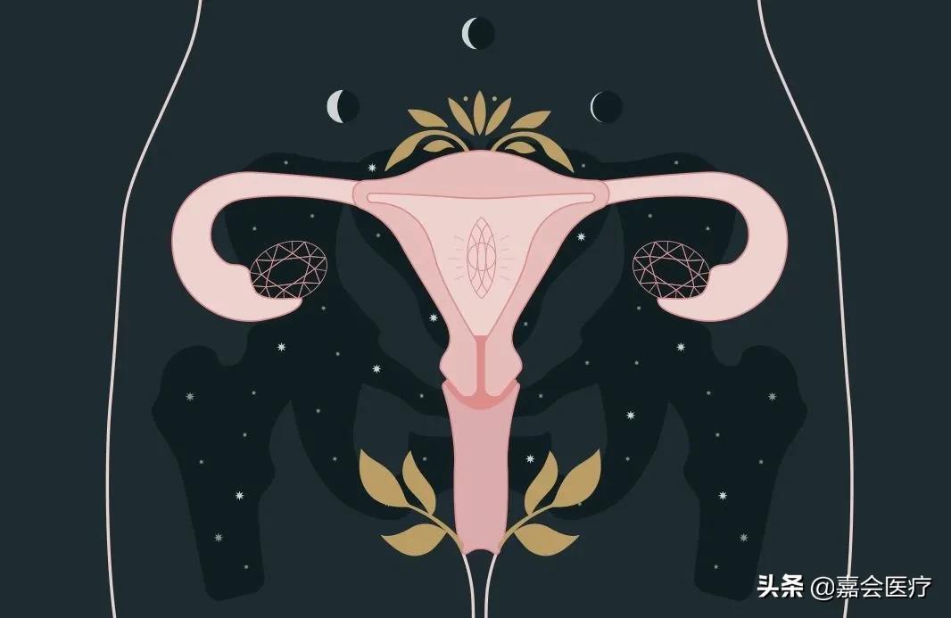 意外怀孕做人流,意外怀孕做人流需要检查什么