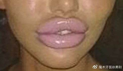 内行人为什么不建议漂唇,作为一名医生一直被人质疑