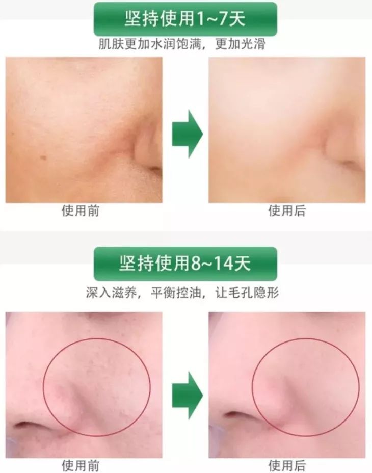 45岁金喜善素颜,金喜善冻龄秘密