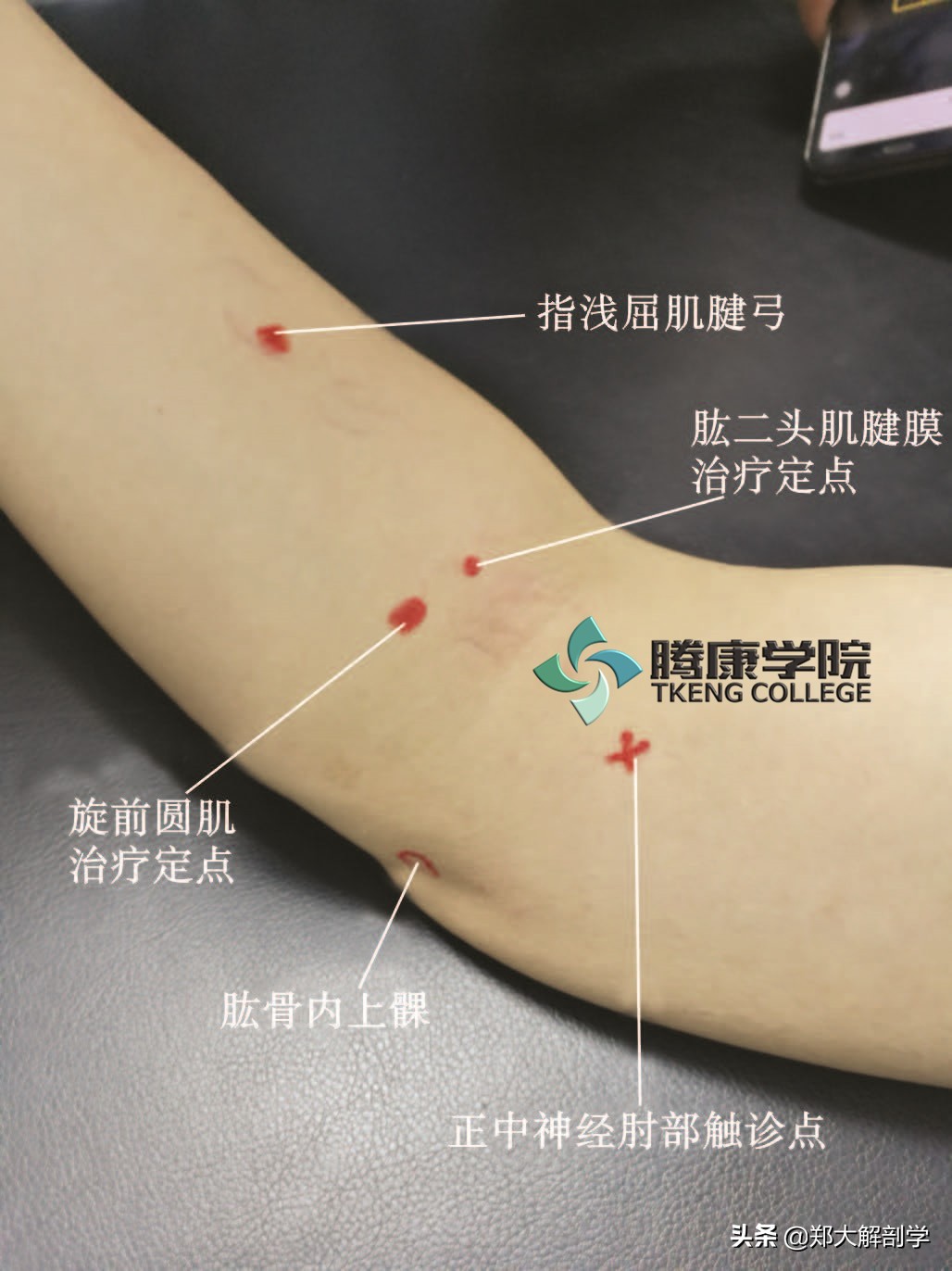 臂丛三束的主要分支,臂丛锁骨下部的主要分支及分布