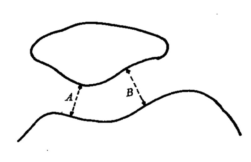 膝关节x线片可以查出啥,膝关节间隙x线测量方法