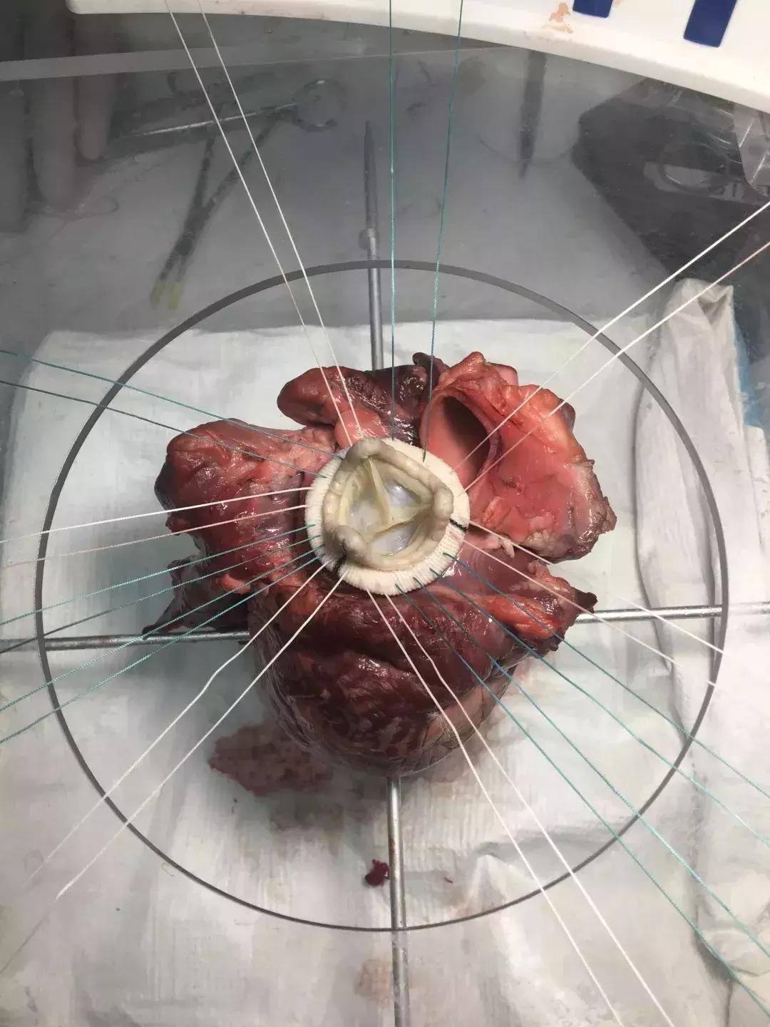 从小幻想做医生的他,开启了剑桥大学临床医学生王者之路