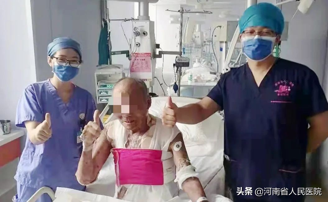 全身换皮手术后续,全身烧伤了换皮能复原吗