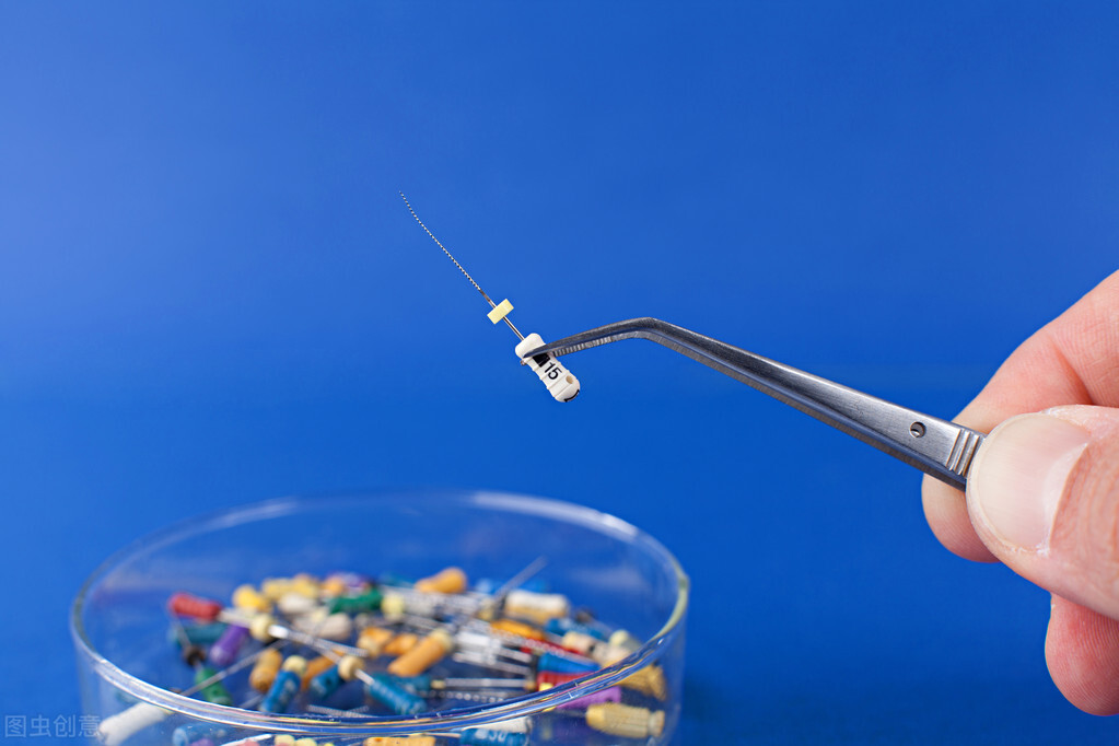 补牙为什么要磨那么大洞,补牙为什么要治疗后才能补