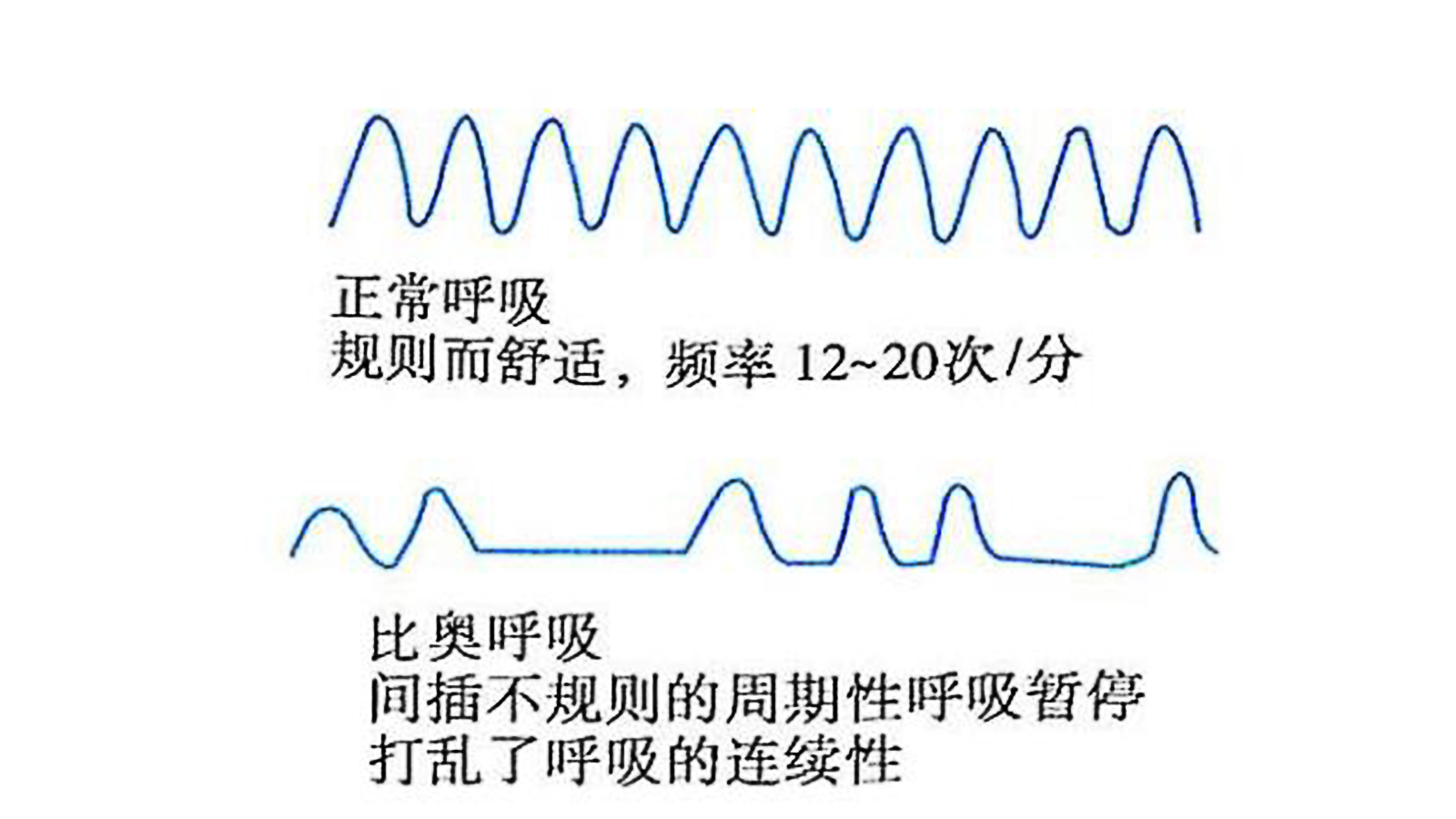喝酒喝到进医院输液,喝酒喝到去医院输液