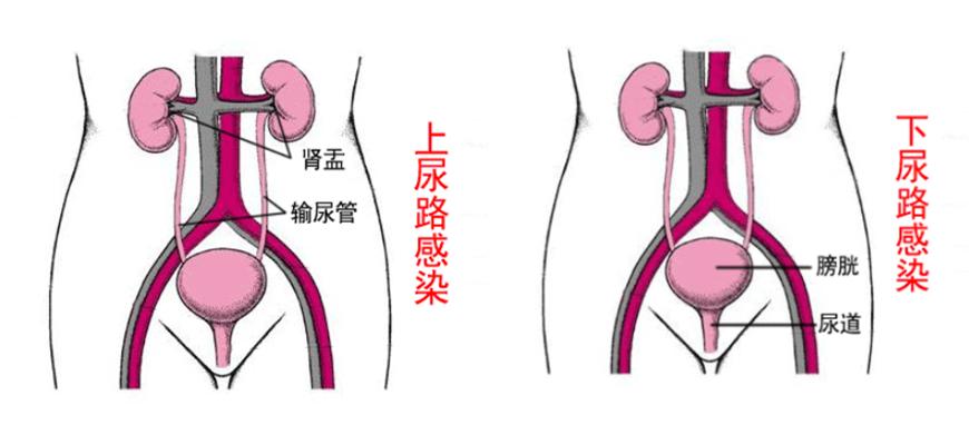 游泳后尿尿疼什么原因,游泳后腰痛