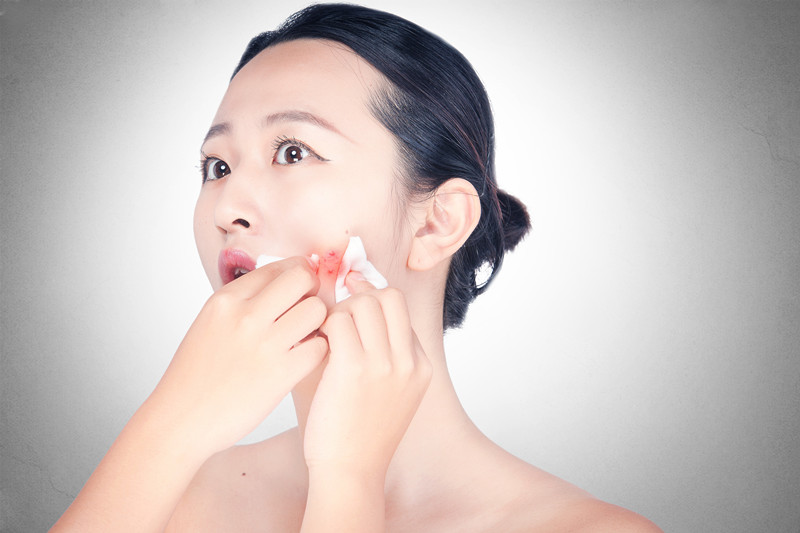 痘印痘坑消炎修复药膏,什么样的痘痘会留痘印痘坑