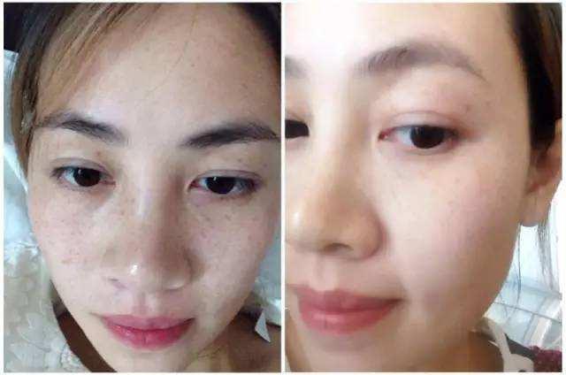 如何在两周内保养好皮肤,怎么样才可以把皮肤越养越好