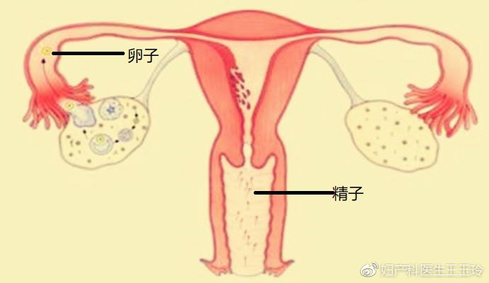 男人功能性障碍可以人工授精吗,人工授精男性该怎么做