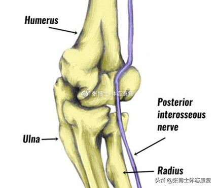肘关节康复锻炼过度会造成什么,运动过量肘关节损伤如何恢复