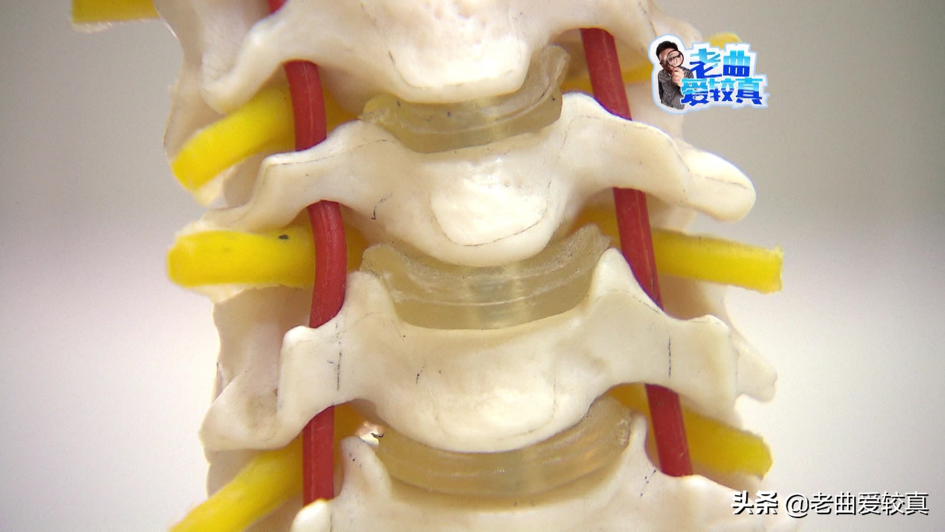 枕酒瓶子治颈椎,枕艾草可以治疗颈椎病吗