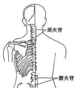 骨刺痛不痛,骨刺常识