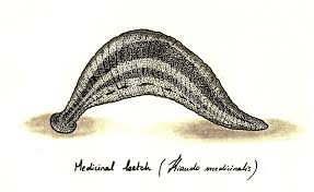 水蛭吸血可治病？结果几百年前的西方人因此导致梅毒的交叉感染