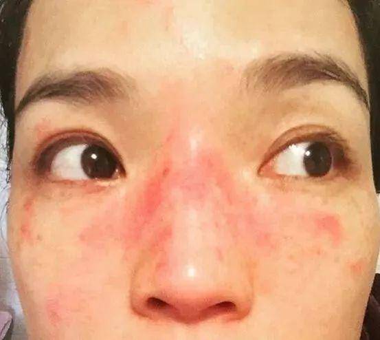 保湿补水霜片仔癀,片仔癀补水防晒