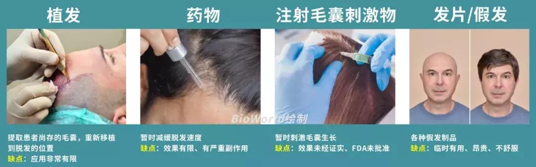 诺奖成果,头发再生最新研究成果