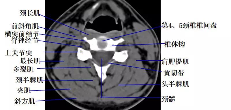 颈椎腰椎疾病ct及mri诊断,腰椎ct可以发现肠部病变吗
