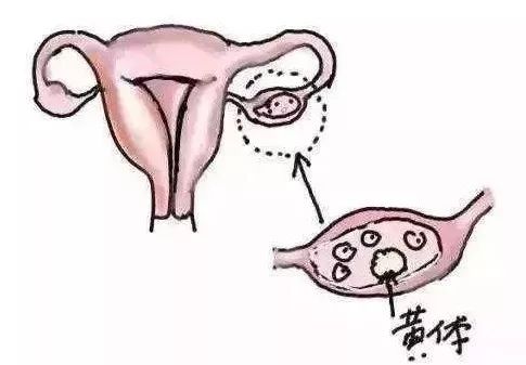 妇科疾病不去医院会好吗,妇科炎症是不是要先去医院检查