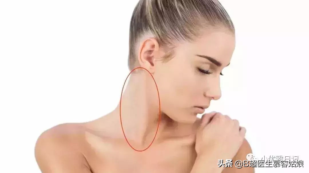 宝宝老是歪头后仰头,宝宝歪脖歪头怎么办