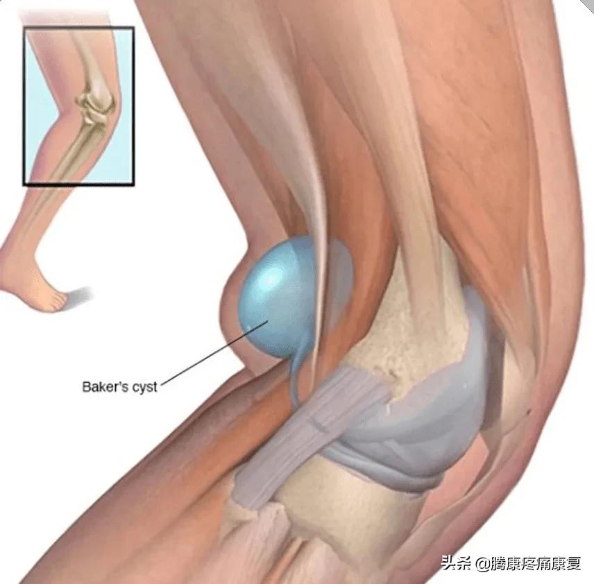 老人小腿疼痛是什么原因,小腿疼痛是什么原因引起的