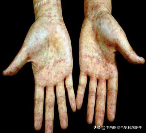 大保健后你忧虑吗？